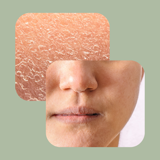 Tørr hudtype - Enkel Rutine