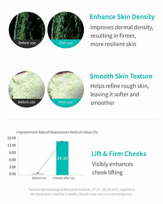 REJURAN® Turnover Ampule