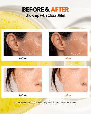 SEOUL 1988 GLOW SERUM : NIACINAMIDE 15% + YUJA