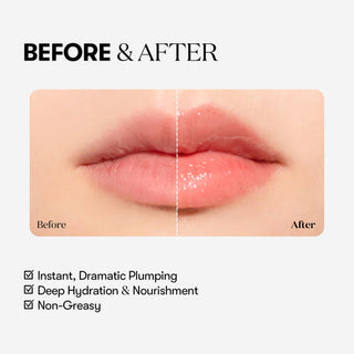 VT Cosmetics Reedle Shot Lip Plumper Expert