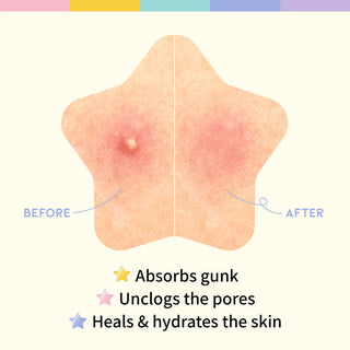 OOTD BEAUTY Star Spot Patch 80 patches